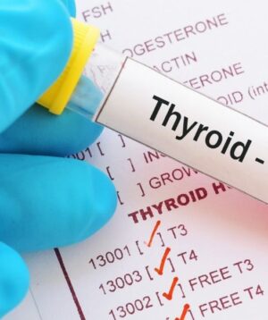Thyroid Profile (T3, T4, TSH)