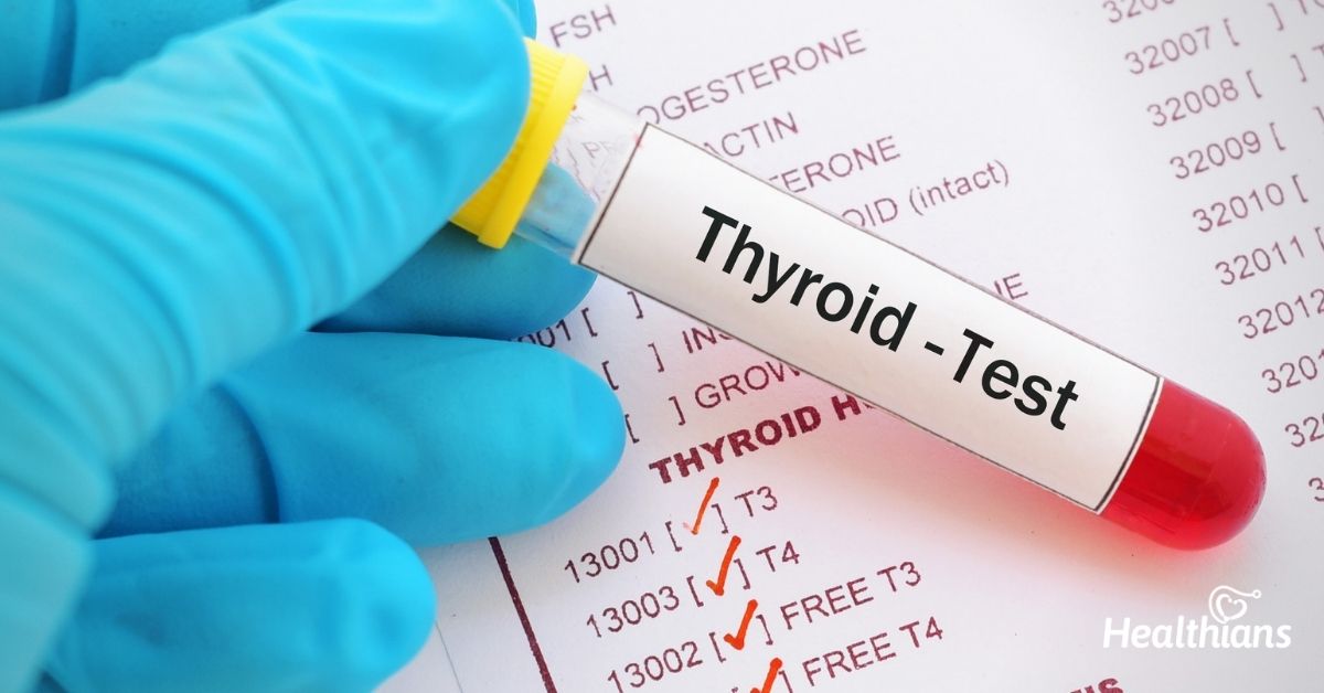 Thyroid Profile (T3, T4, TSH)