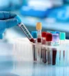 blood-test