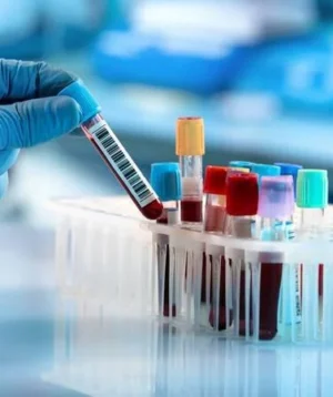 All Routine Blood Tests