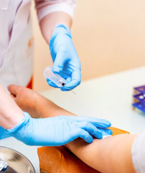 Home Sample Collection Available