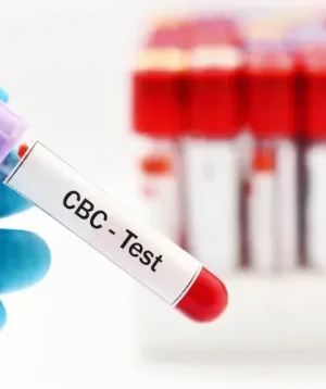 CBC, LFT, KFT & Lipid Profile